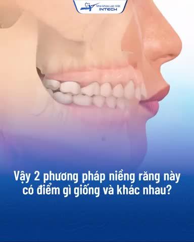 Niềng răng mặt trong và mặt ngoài đều giải quyết tốt những khuyết điểm răng hô