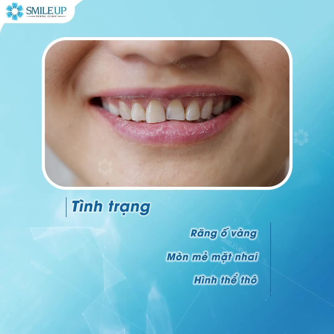 SMILE UP - SỨC SỐNG MỚI CHO NỤ CƯỜI