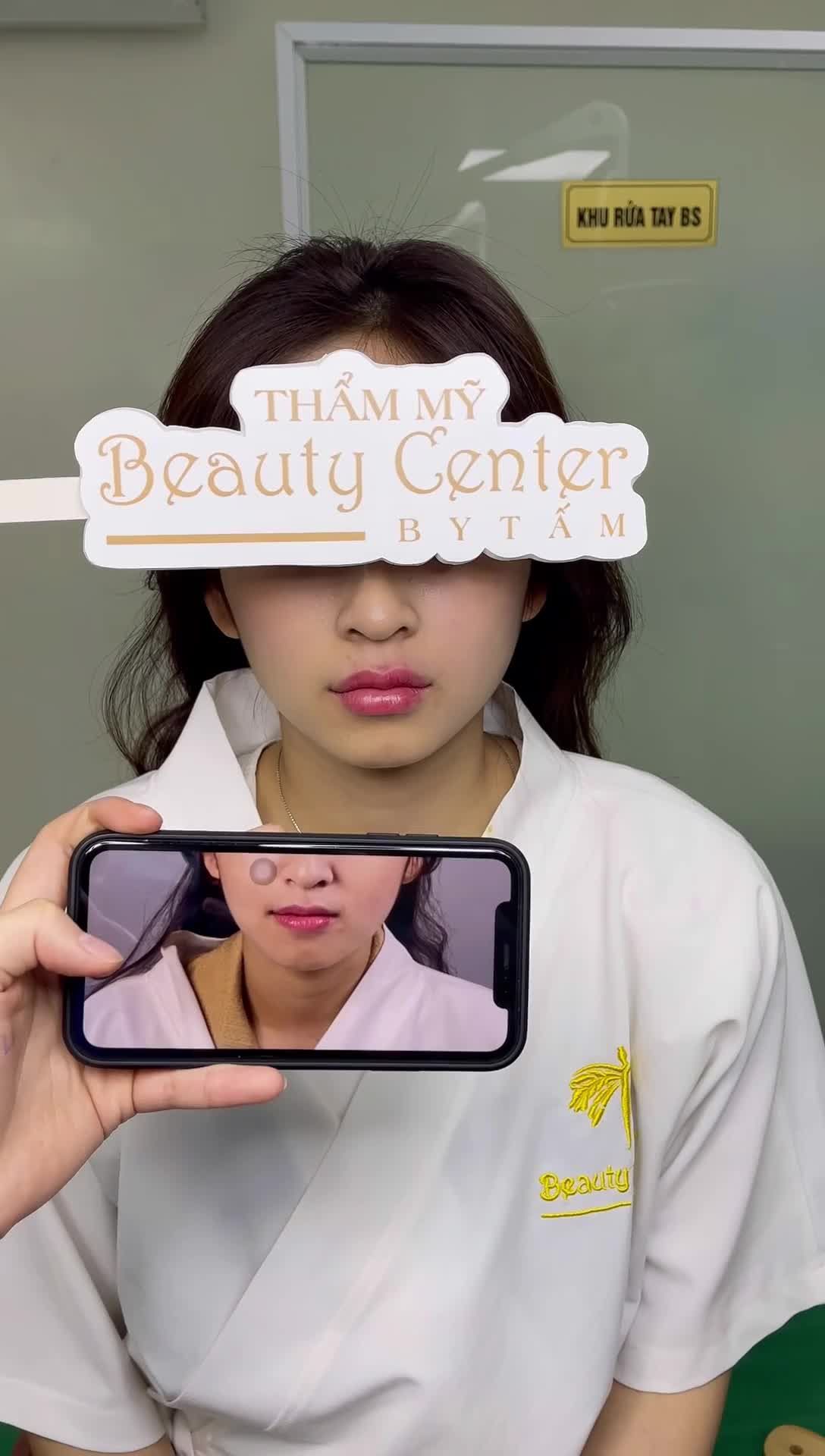 TẠO HÌNH FILLER MÔI -GIẢI PHÁP TỐI ƯU ĐỂ SỞ HỮU ĐÔI MÔI QUYẾN RŨ, CĂNG MỌNG
