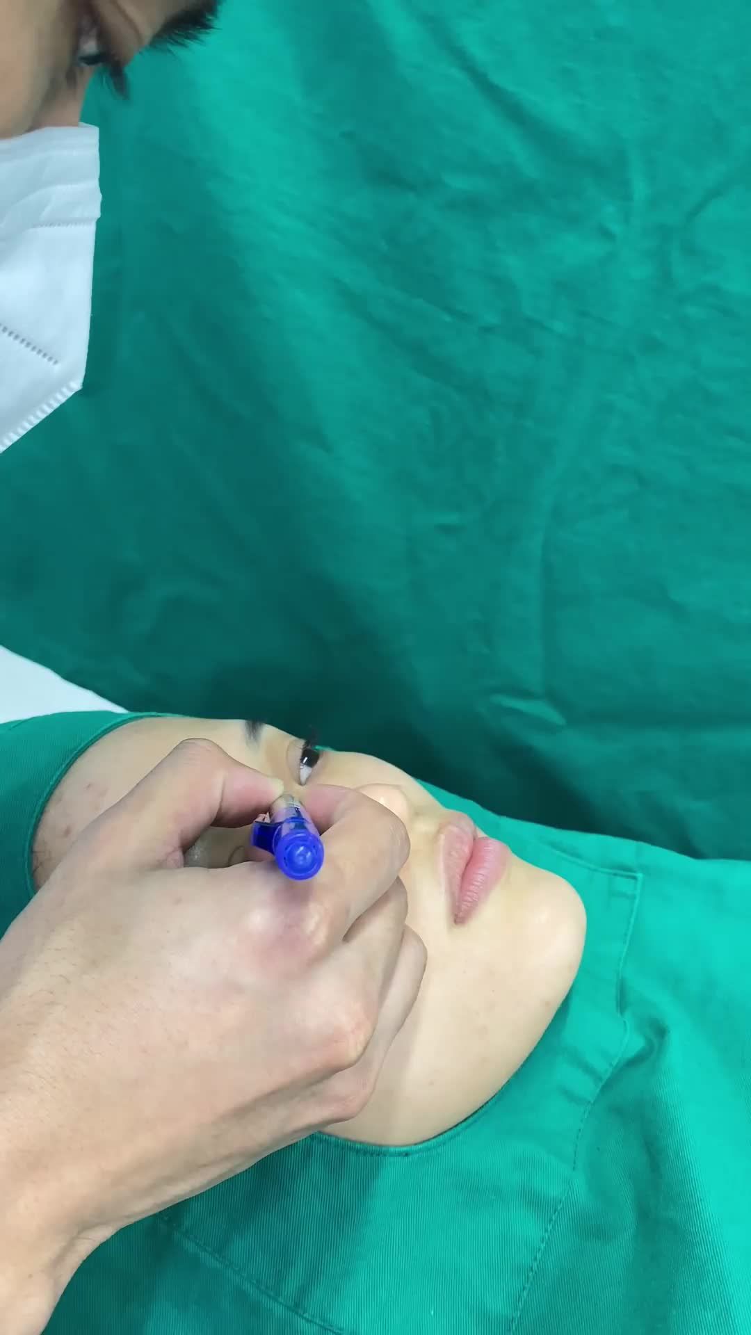 Bác sĩ phân tích tình trạng mũi khách hàng trước khi tiến hành nâng