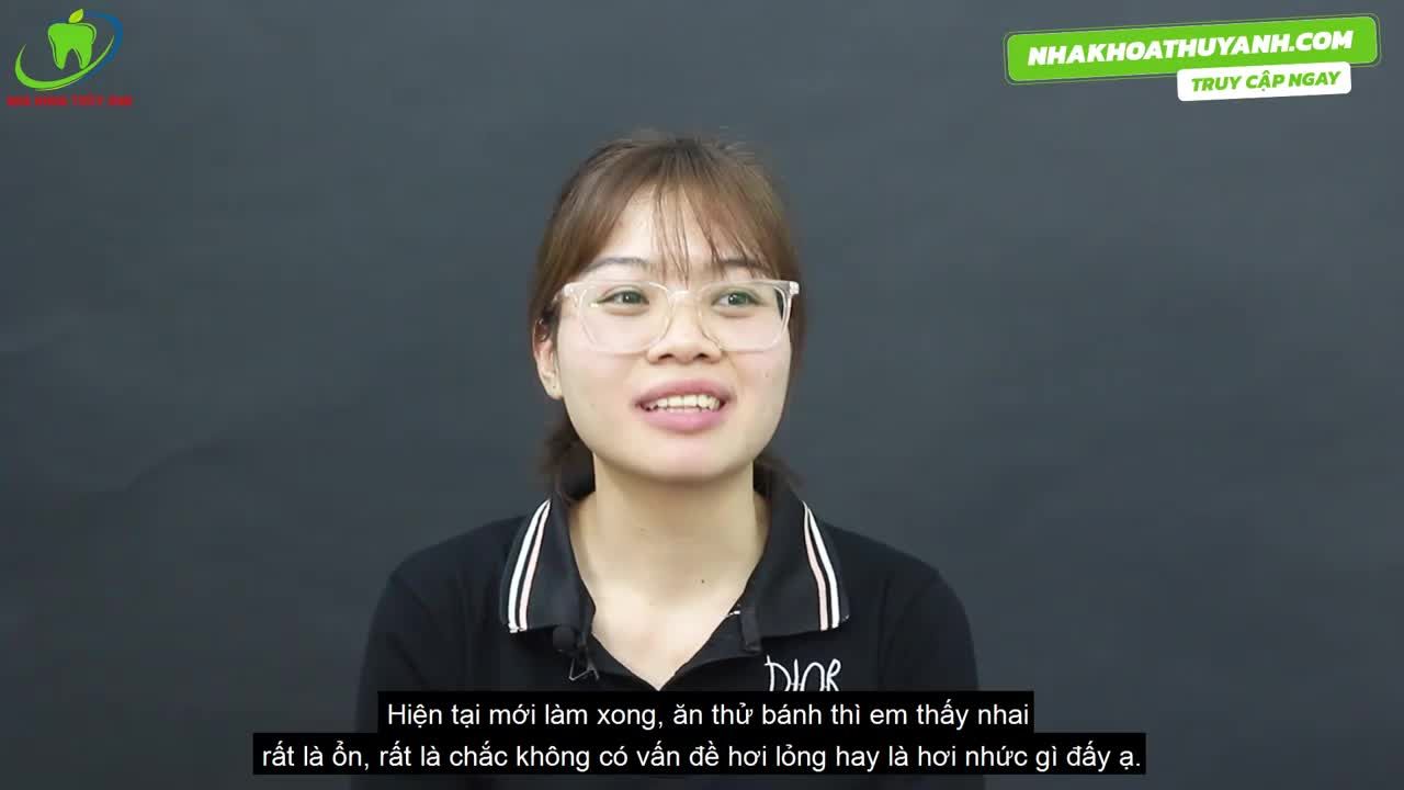 IMPLANT - SỰ LỰA CHỌN HOÀN HẢO KHI MẤT RĂNG