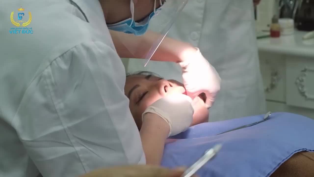 RĂNG SỨ THẨM MỸ - NHA KHOA QUỐC TẾ VIỆT ĐỨC