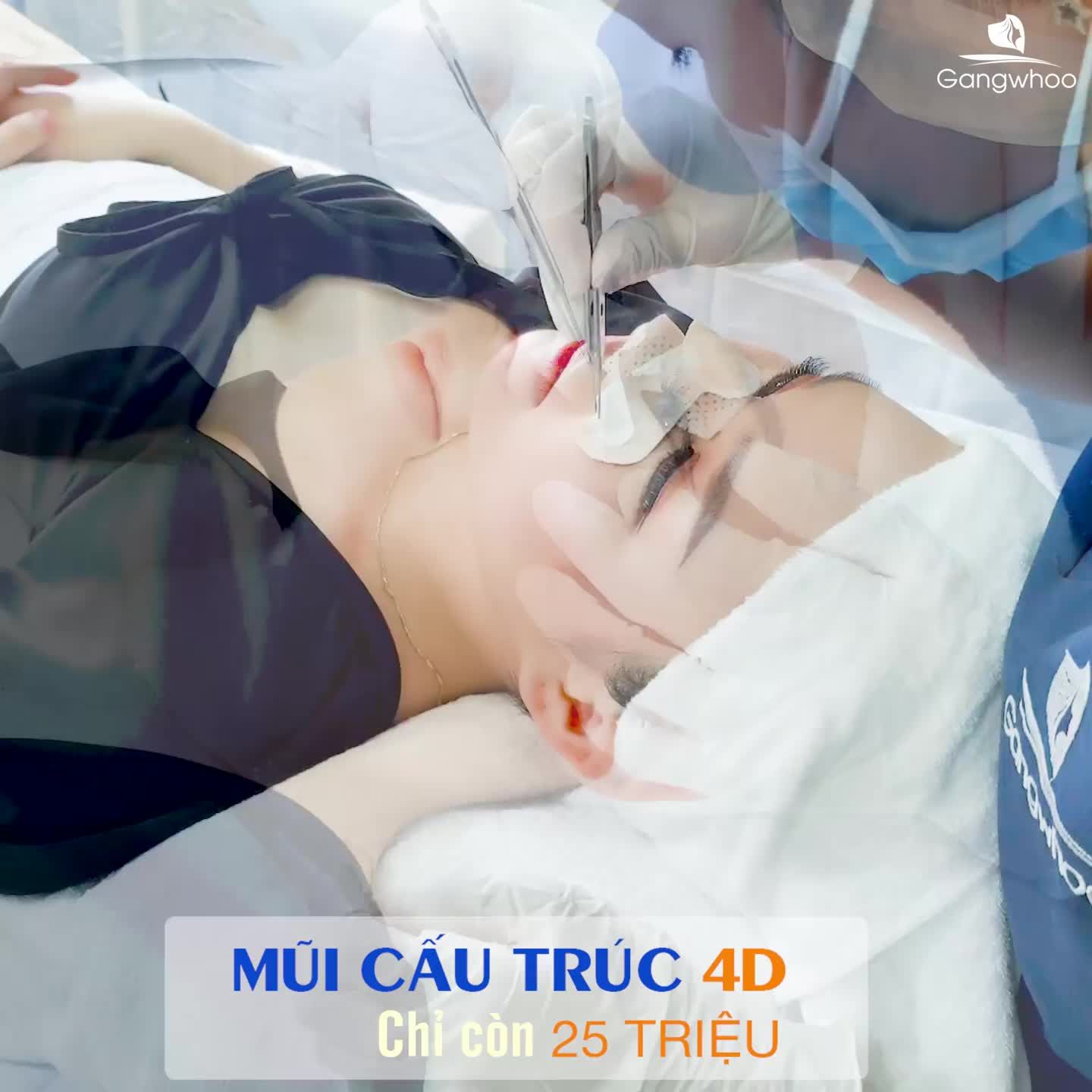 NÂNG MŨI CẤU TRÚC - BẠN ĐÃ HIỂU HẾT VỀ PHƯƠNG PHÁP NÀY