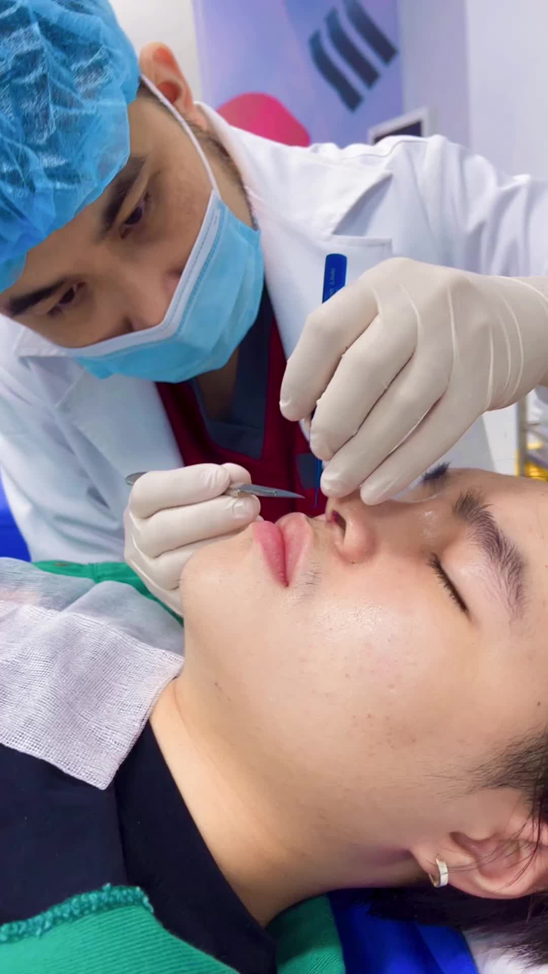 NÂNG MŨI CẤU TRÚC 4D và cắt chỉ xong ĐẸP MÊ