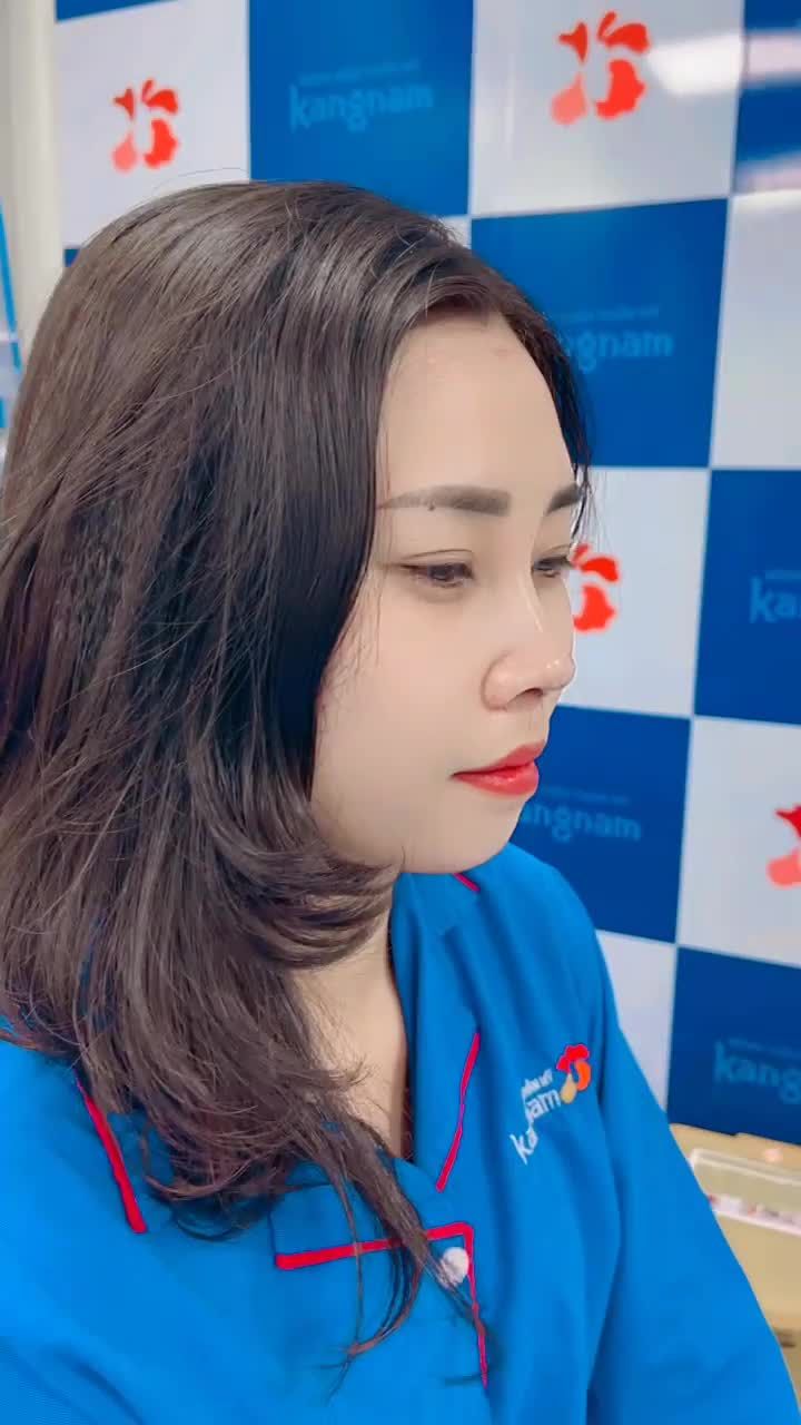 Trực tiếp khách hàng vừa nâng mũi Cấu trúc 4D - Dáng mũi S-Line tại Kangnam 666 Cách Mạng Tháng 8