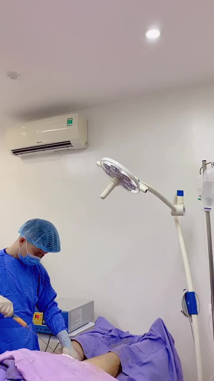 Quá trình lấy mỡ nội soi Bio Gen cấy mỡ mặt