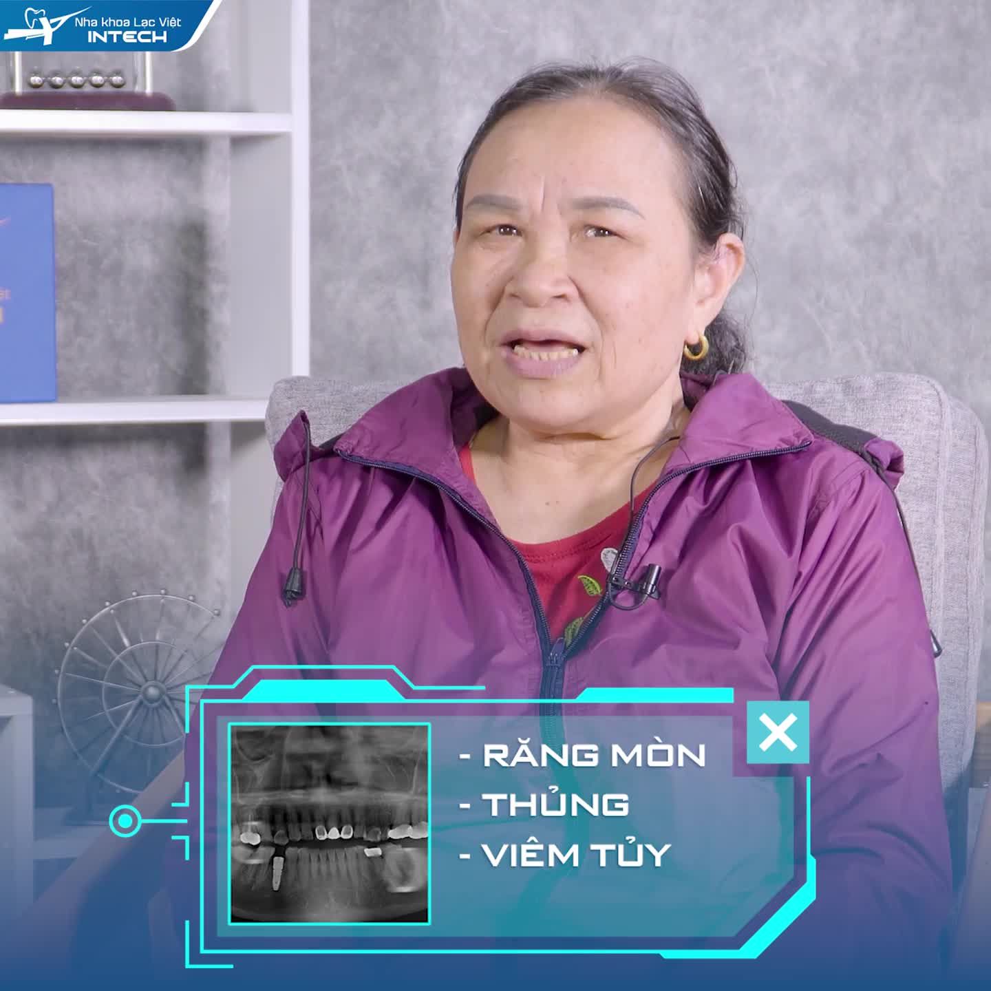 Trồng răng Implant Công nghệ Safe Tech