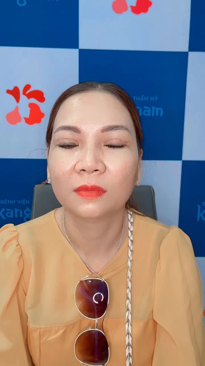 Điểm 10 chất lượng cho kết quả cắt mí siêu xinh của nữ khách hàng