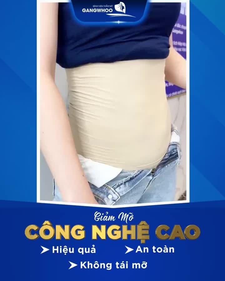 MỠ THỪA - LIPO ULTRASOUND CÓ GIÚP BẠN ĐƯỢC KHÔNG