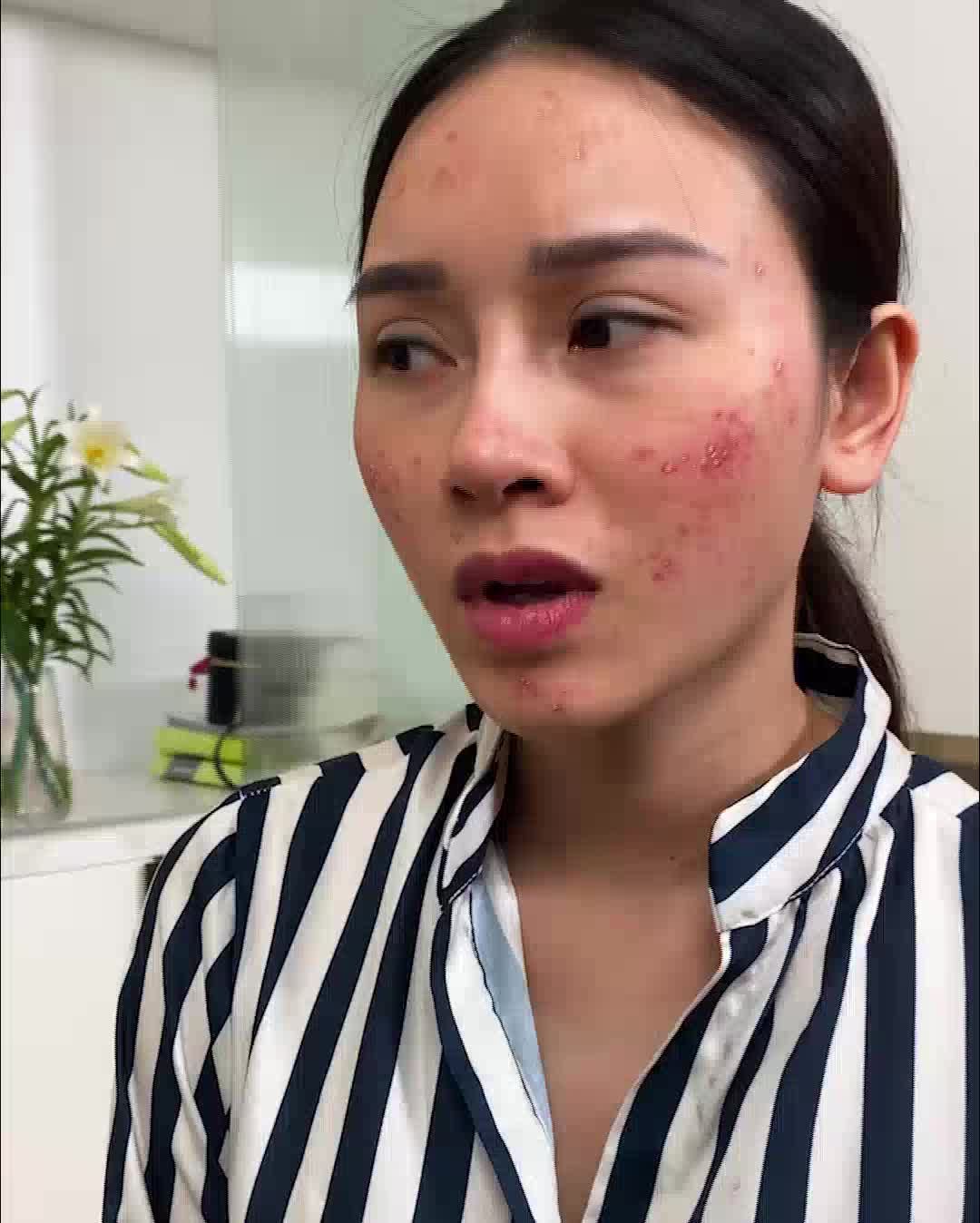 HAM GIÁ RẺ - TRẢ GIÁ ĐẮT KHI SỬ DỤNG KEM TRỘN KHÔNG RÕ NGUỒN GỐC