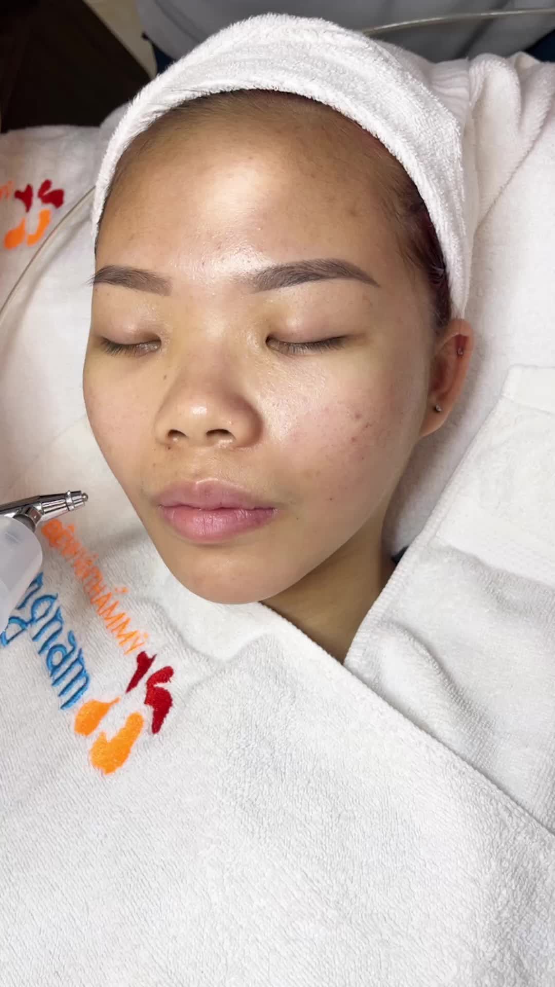 Công nghệ điều trị Mụn De-acne siêu việt tại Kangnam. Cùng theo dõi quá trình điều trị cùng các sản phẩm và công nghệ máy cao cấp