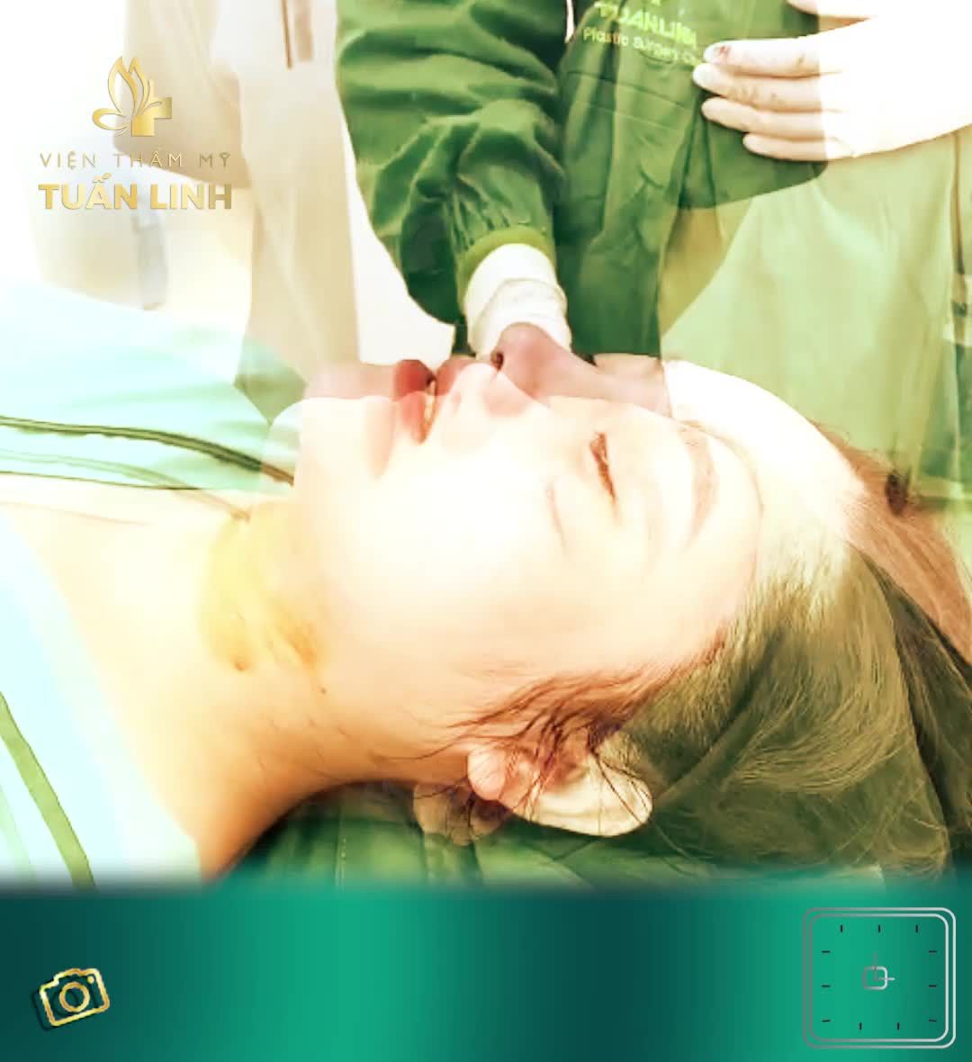 MŨI CẤU TRÚC ĐẸP ''MÊ NGƯỜI SAU 90 PHÚT PHẪU THUẬT