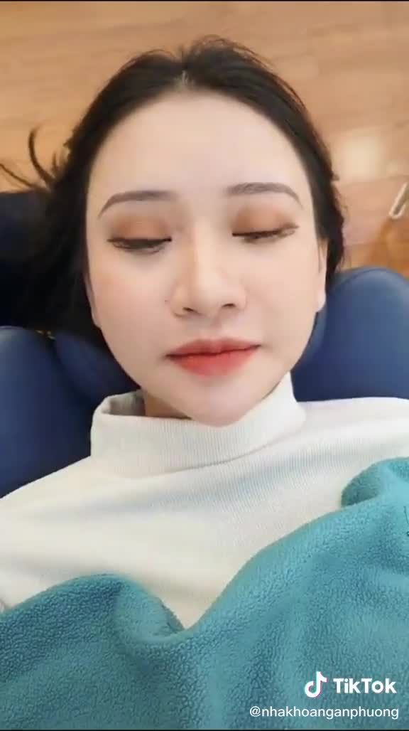 Biến hình 180 độ với răng sứ thẩm mỹ