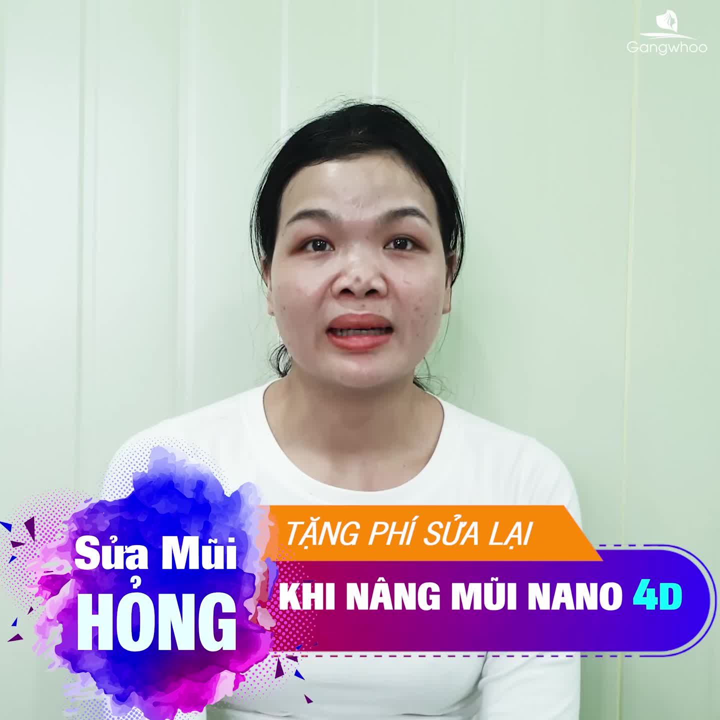 MŨI HỎNG - NHỮNG LƯU Ý TRƯỚC KHI SỬA LẠI
