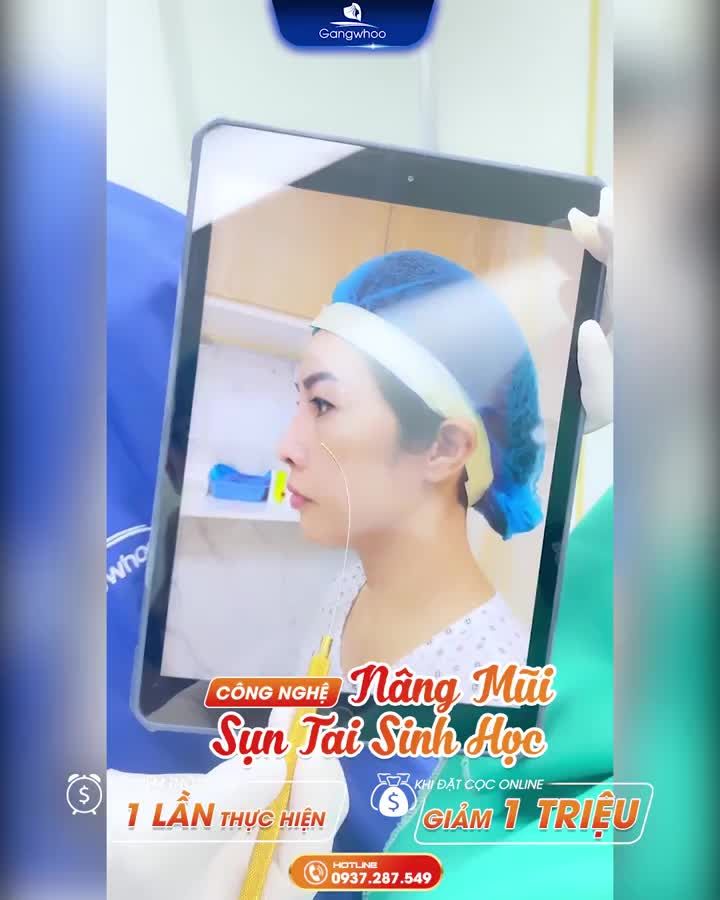 BẠN ĐÃ BIẾT ĐẾN CÔNG NGHỆ NÂNG MŨI SỤN TAI SINH HỌC