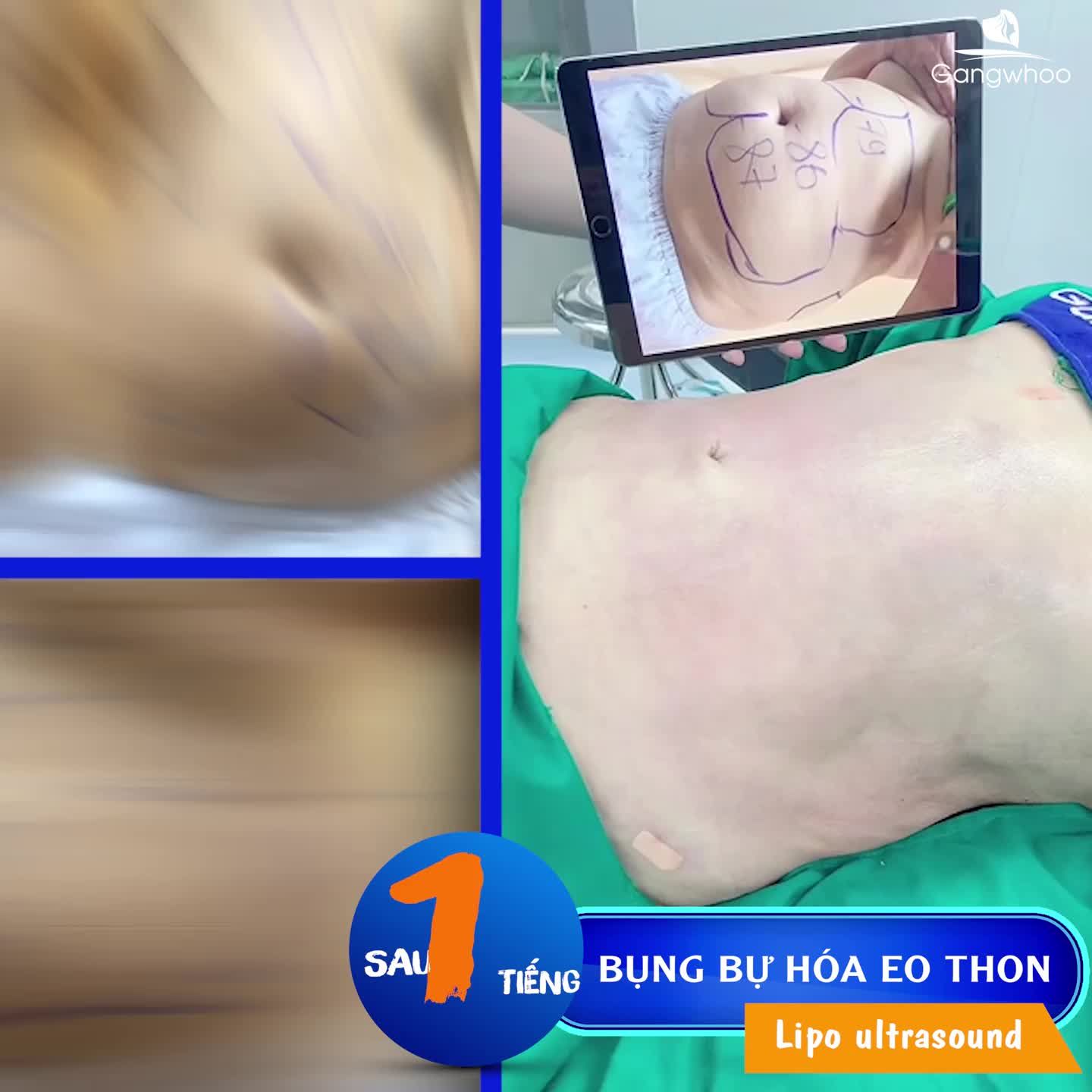 60 PHÚT VÌ SAO MỠ THỪA LẠI BAY HẾT