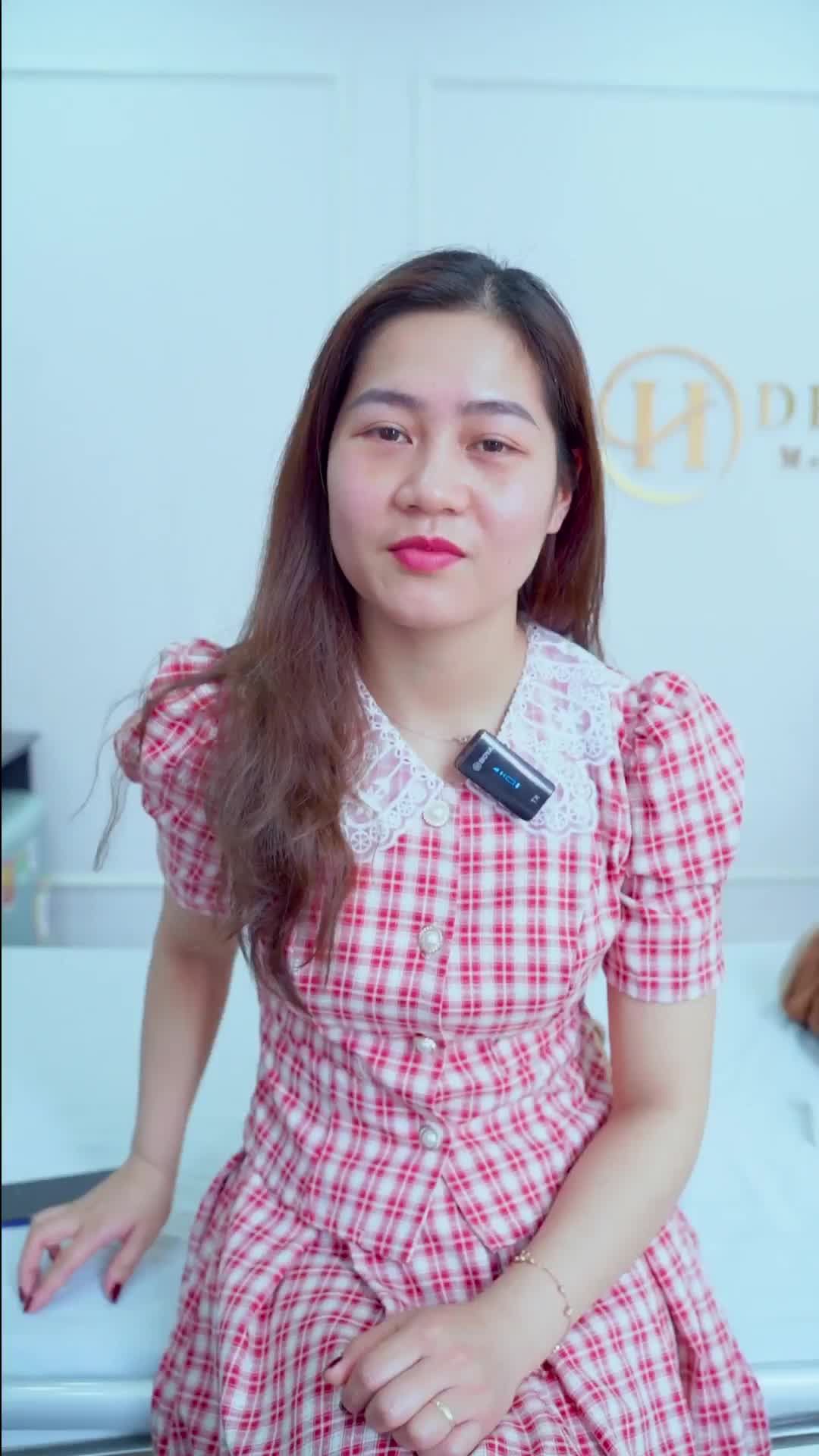 Chiêm ngưỡng ngay tác phẩm sau 7 ngày sau khi cắt mí của chị khách hàng dưới đây để cùng thấy được sự thây đổi của khách hàng