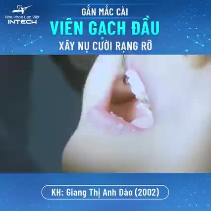 GẮN MẮC CÀI - VIÊN GẠCH ĐẦU XÂY NỤ CƯỜI RẠNG RỠ