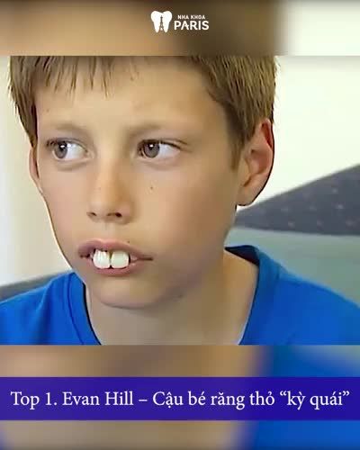 TOP 5 HÀM RĂNG XẤU NHẤT THẾ GIỚI