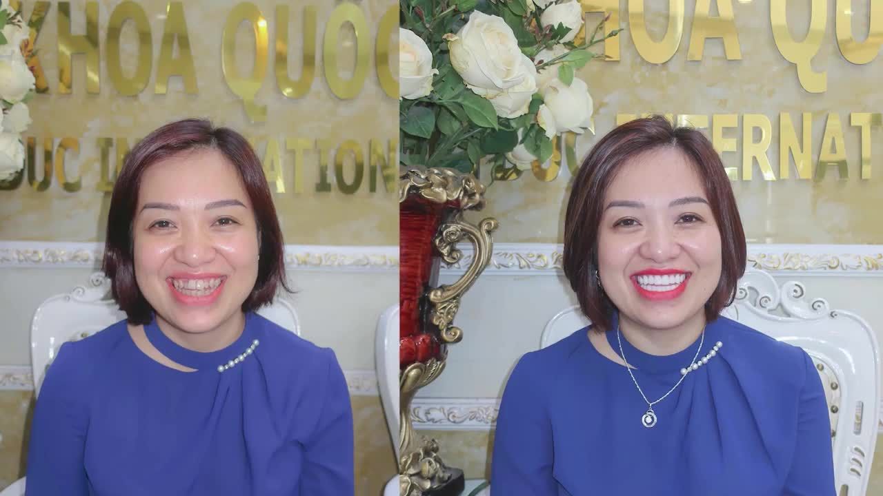 RĂNG SỨ THẨM MỸ - NHA KHOA QUỐC TẾ VIỆT ĐỨC