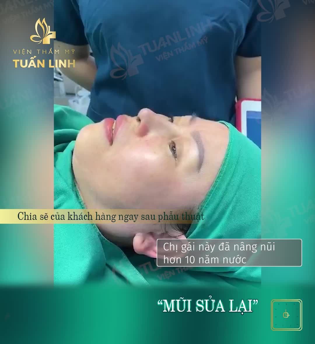 Cận cảnh mũi cấu trúc Surgiform