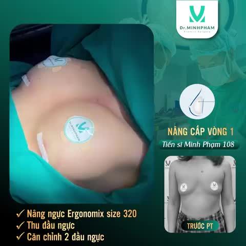 CHIÊM NGƯỠNG CA NÂNG CẤP V1 NHIỀU KHUYẾT ĐIỂM CHO CHỊ KHÁCH