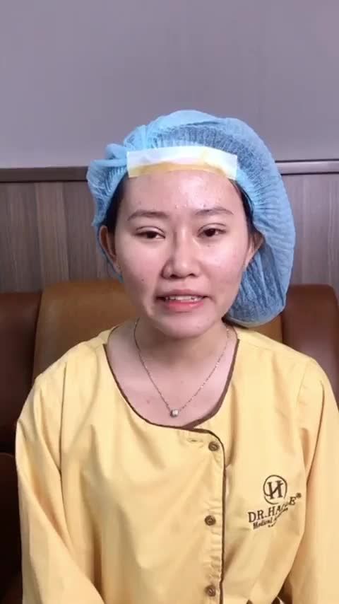 Mí to nhỏ không đều có cách nào khắc phục Theo dõi ngay sau đây bạn nhé