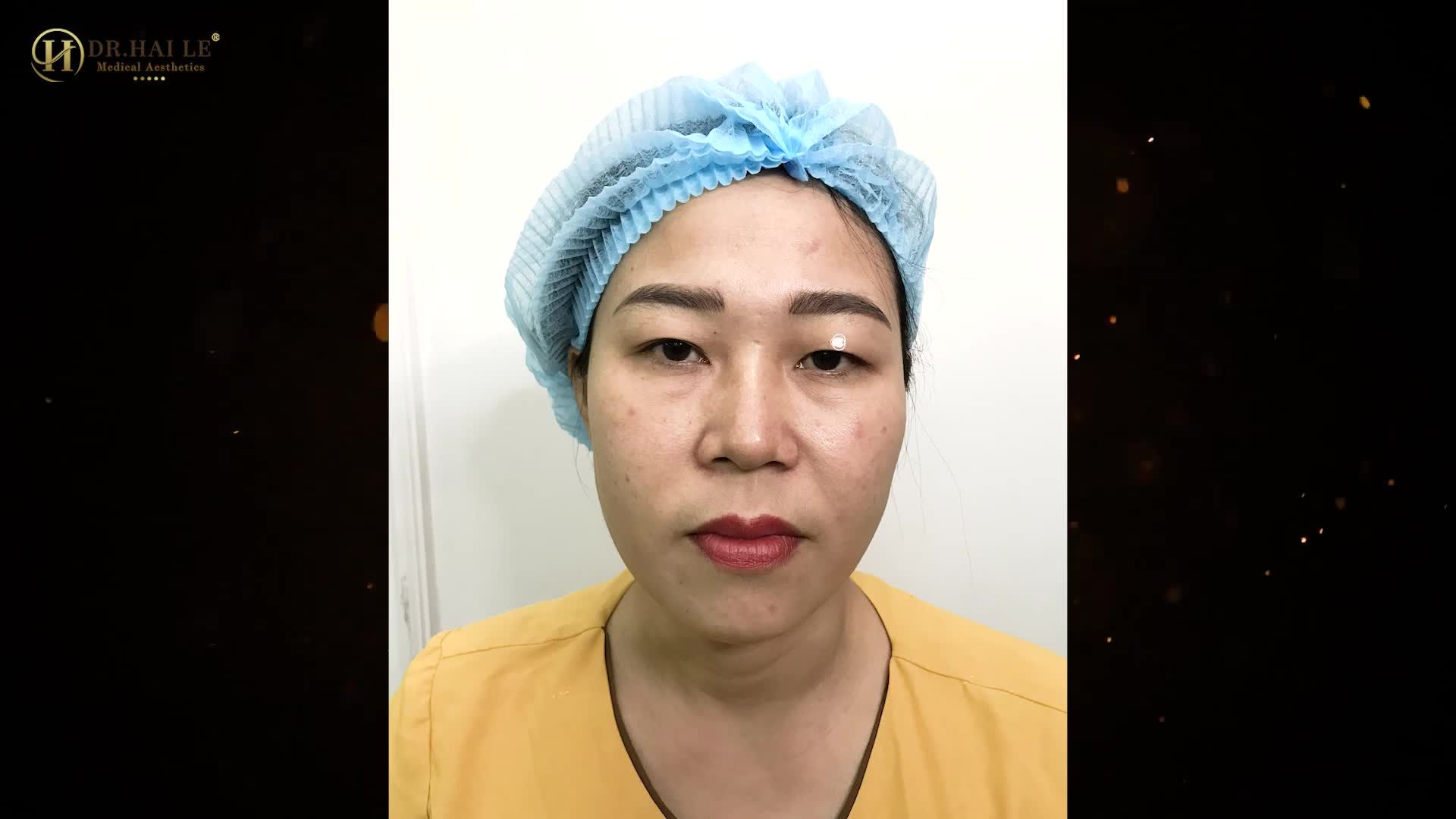 DR.HẢI LÊ SỐ 1 CẮT MÍ ĐẸP VÀ AN TOÀN