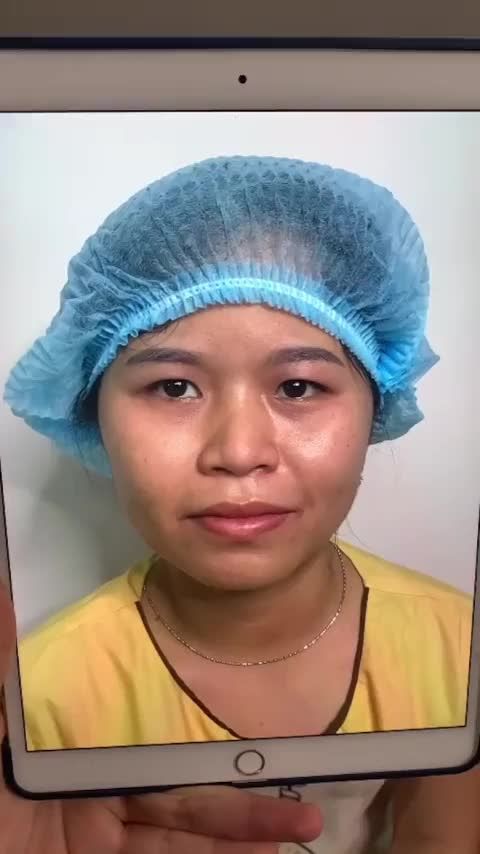 Tại sao Dr.Hải Lê HCM lại được khách hàng lựa chọn là địa chỉ uy tín để thẩm mỹ mắt