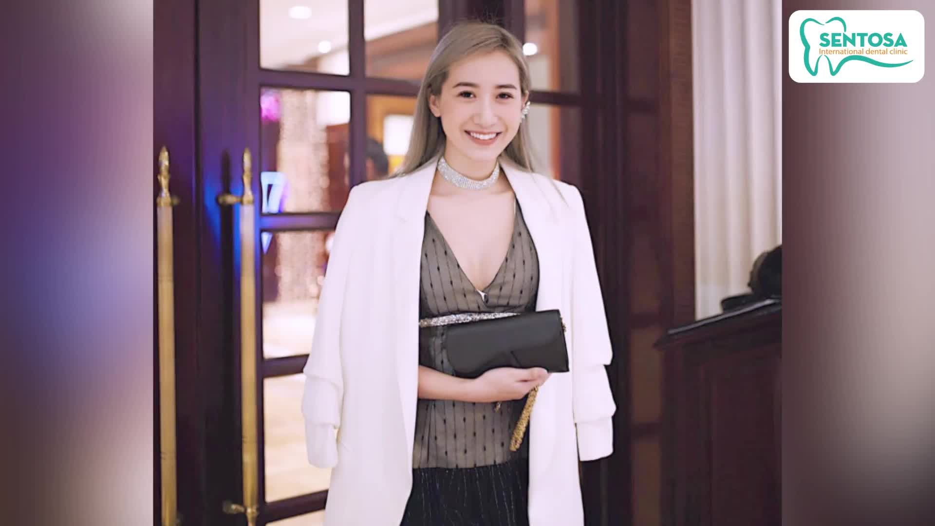 Lý do Kiều Ly Phạm lựa chọn niềng răng vô hình INVISALIGN!