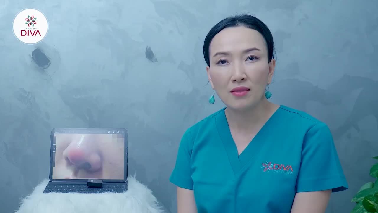 NÂNG MŨI BỊ LỖI GIẢI PHÁP LÀ GÌ