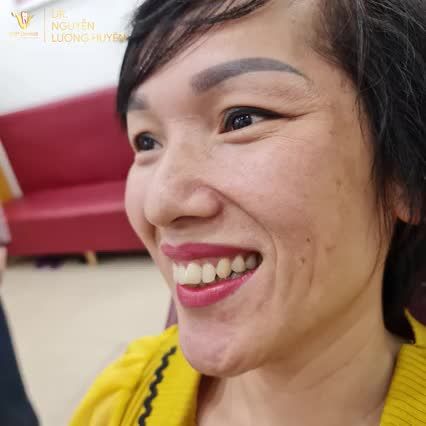 2 YẾU TỐ TẠO NÊN SỨC HÚT RĂNG SỨ VIP DENTIST