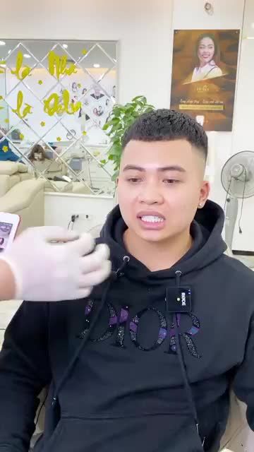 Anh Vũ (Hạ Long) tái khám sau 1 tuần thẩm mỹ răng sứ