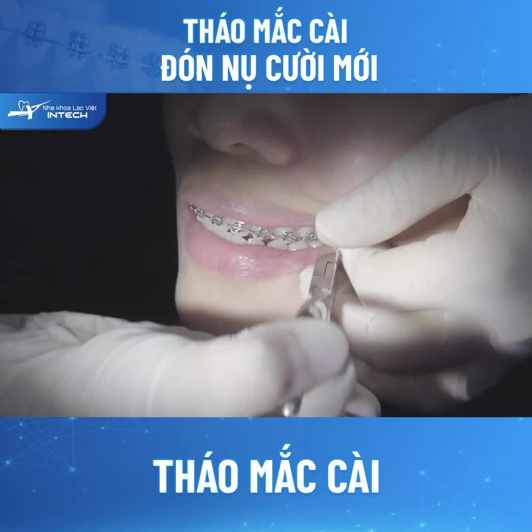 THÁO MẮC CÀI - ĐÓN NỤ CƯỜI MỚI