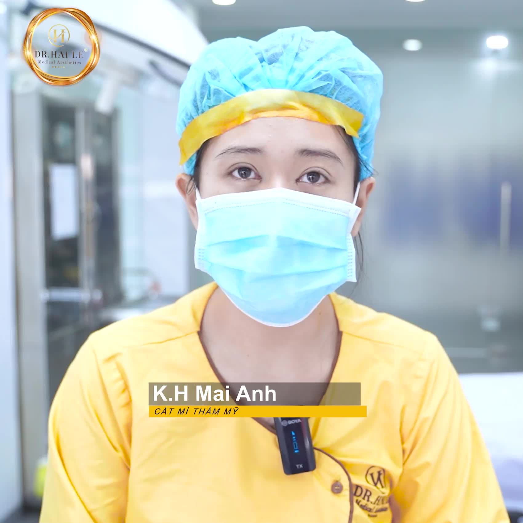 Trước có người khuyên đi cắt mí cho đẹp