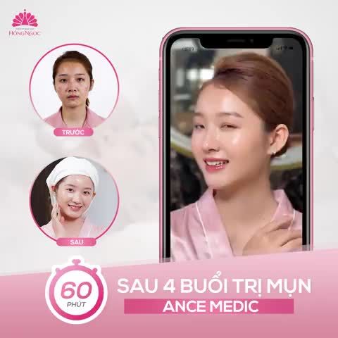 1 LIỆU TRÌNH DUY NHẤT MỤN SẠCH BAY - DIỆN MẠO XINH ĐẸP NGAY CHỈ TỪ #582K