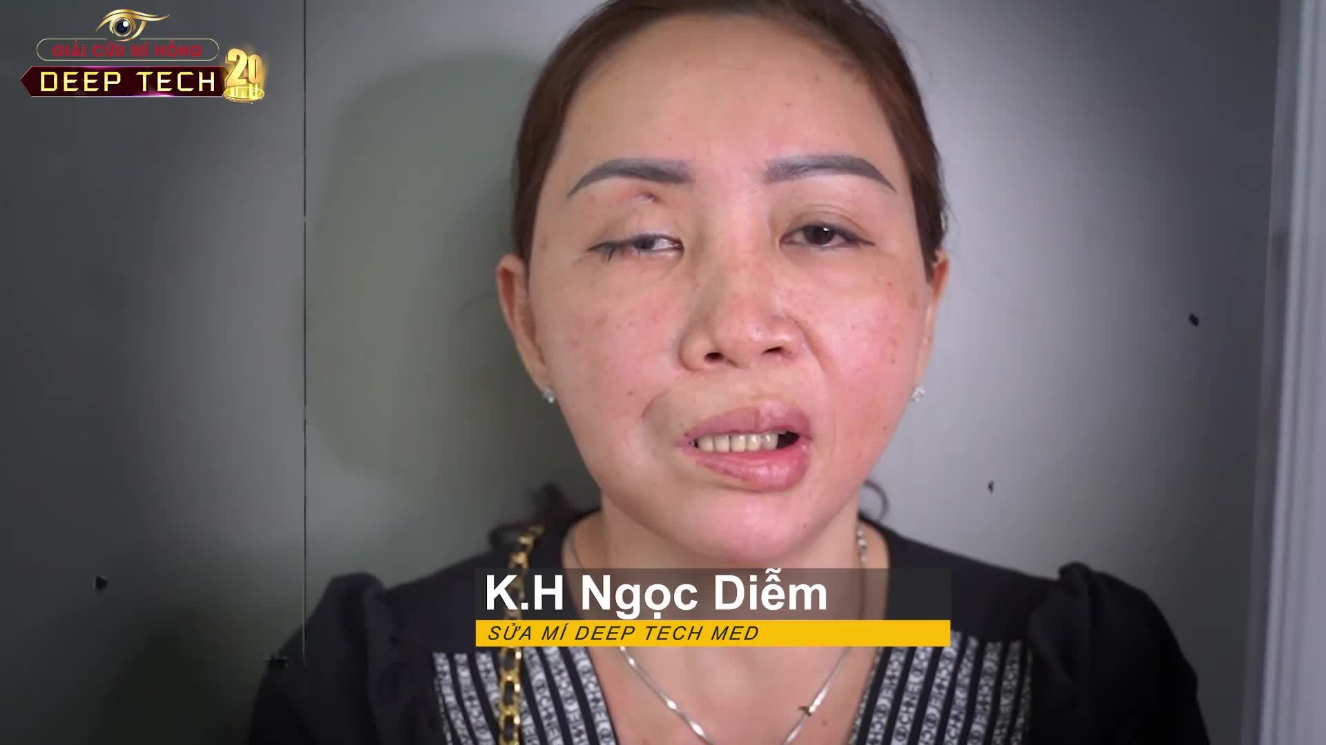 9 năm sống trong mặc cảm và tự ti 9 năm với những nỗi buồn và cả sự tuyệt vọng vì đôi mí mắt lỗi, hỏng