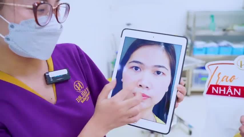 Dr.Hải Lê cắt mí đẹp tự nhiên hài hòa ngay cả khi vừa thực hiện xong mời cả nhà cùng theo dõi