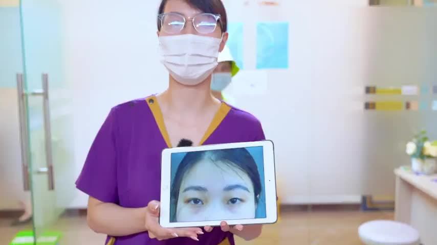 7 ngày sau khi thực hiện Cắt mí tại Dr.Hải Lê khách hàng nói gì Mời cả nhà cùng đón xem