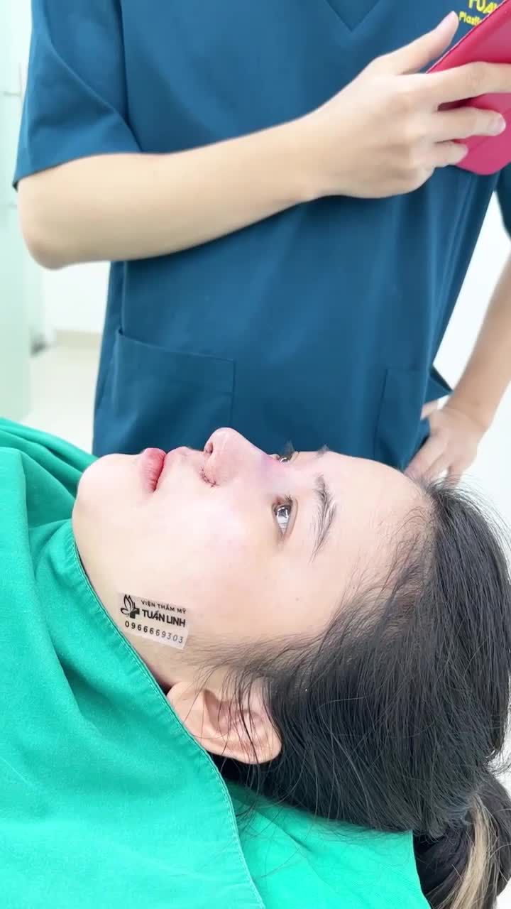 Case mũi Siêu cấu trúc sụn surgiform + cuộn cánh cho cô bé thích nhẹ nhàng
