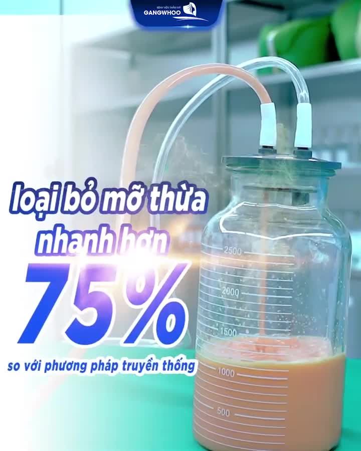 LIPO ULTRASOUND - CÔNG NGHỆ HÚT MỠ ĐỈNH CAO