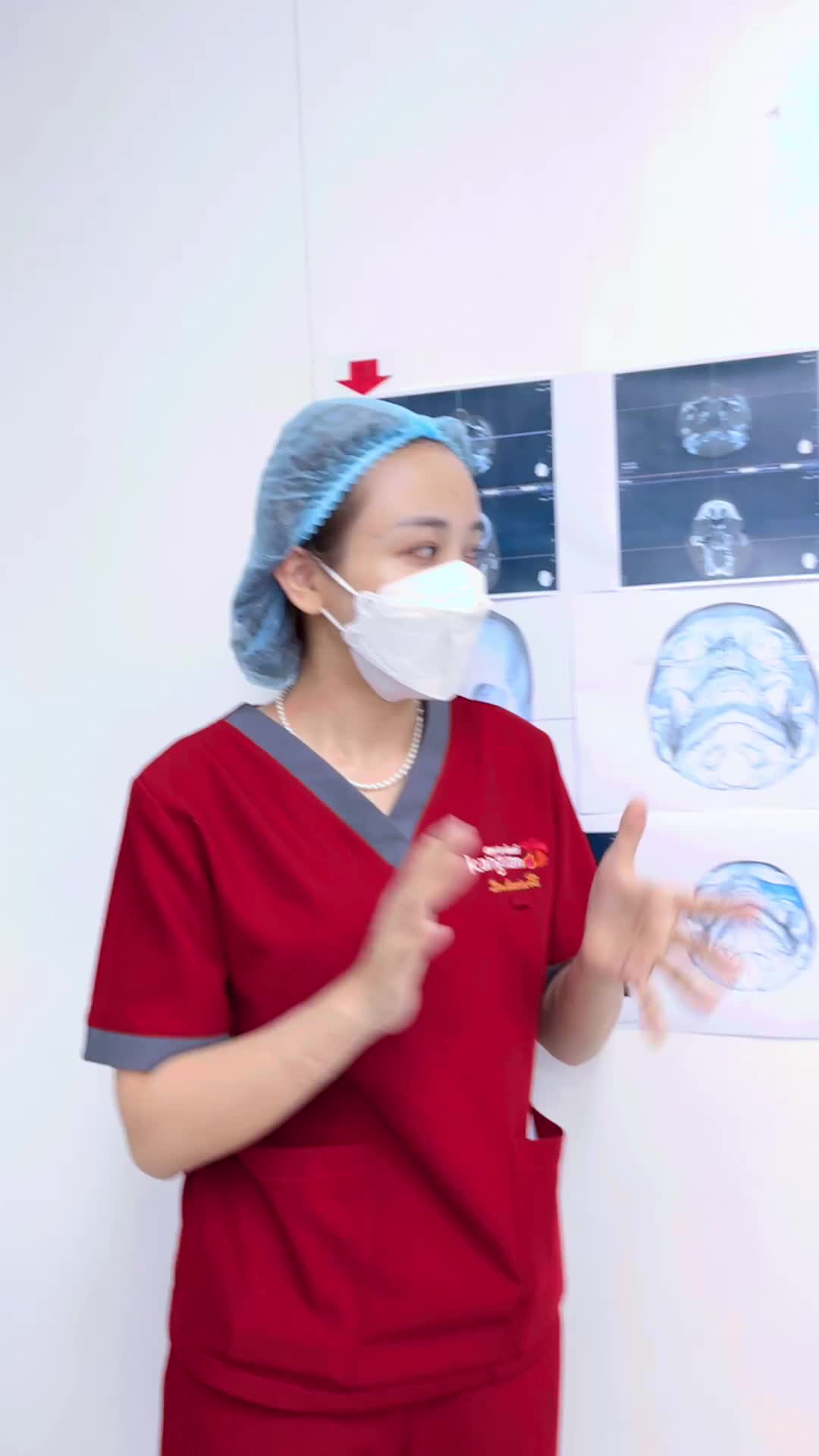 Ca phẫu thuật ghép chất liệu độn cho khách hàng thiểu sản xương gò má tại Kangnam