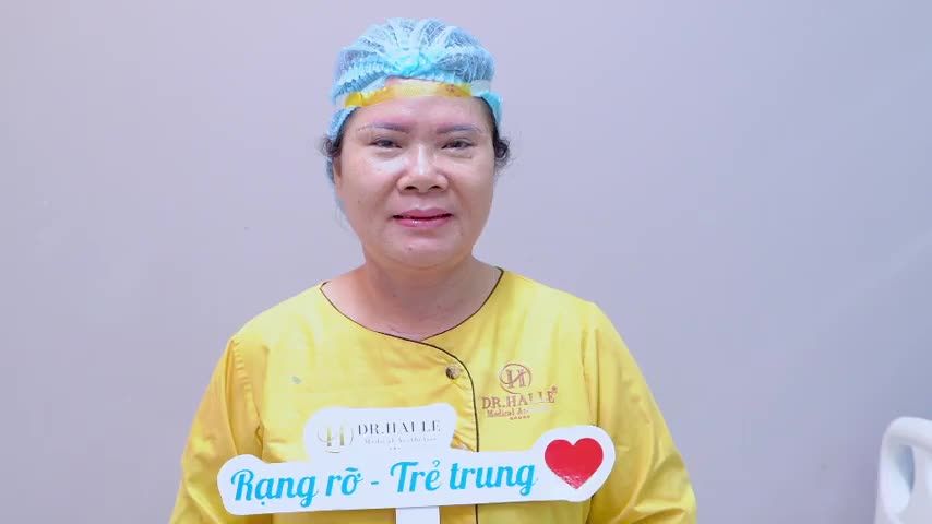 Sụp mí tuổi trung niên khắc phục bằng cách nào hiệu quả Theo dõi video này quý vị khách hàng nhé