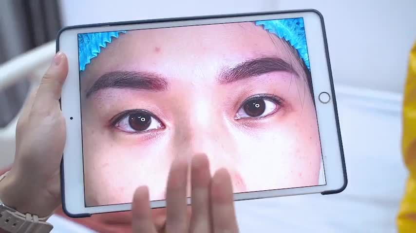 Mình đã rất vui khi soi gương, không nghĩ làm mí xong mắt lại đẹp mà trẻ thế!