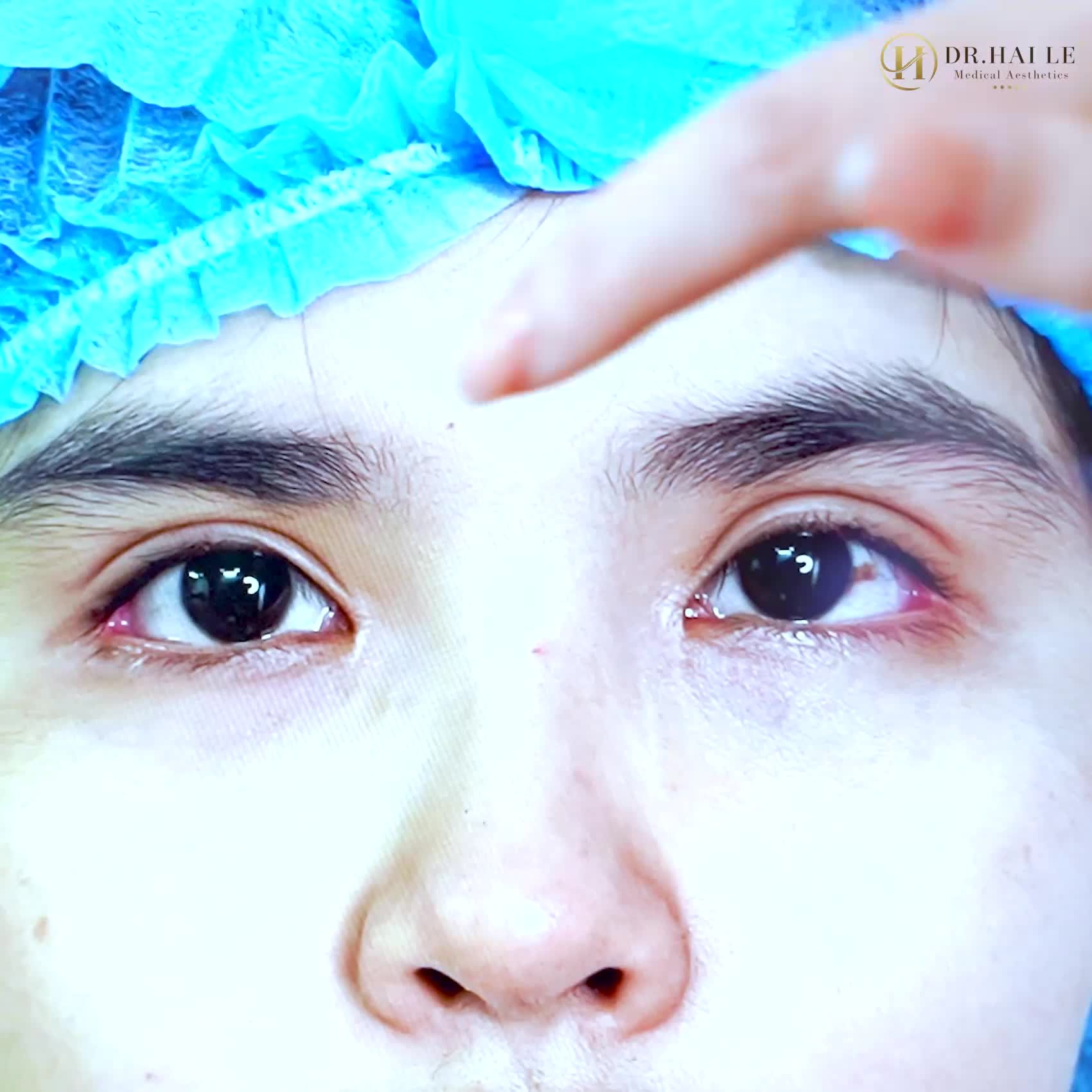 Mỗi một khách hàng với một dịch vụ thẩm mỹ mắt khác nhau nhưng trên tất cả đó là SỰ HÀI LÒNG, SỰ TIN TƯỞNG TUYỆT ĐỐI vào VTM Dr.Hải Lê.