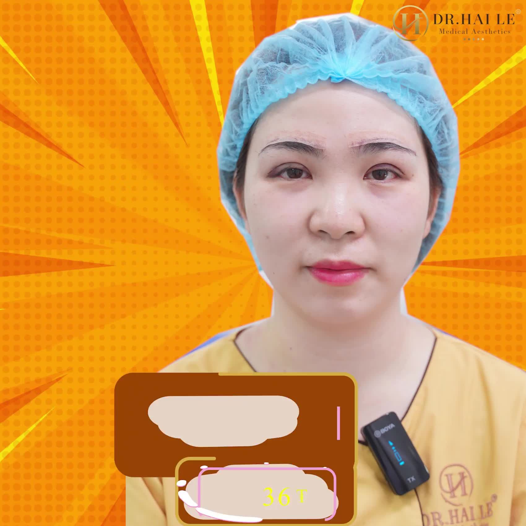 60 phút thay đổi diện mạo với Combo Cắt mí nâng cung mày.