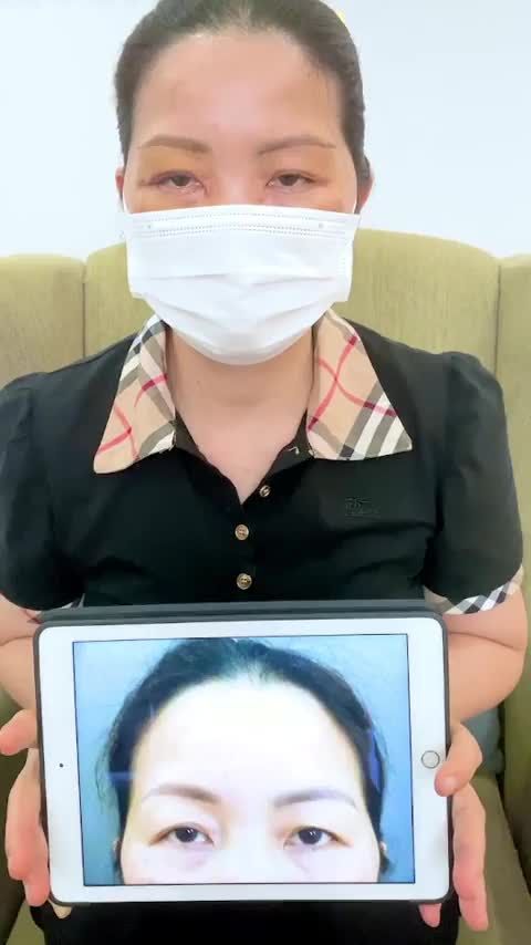Sau 7 ngày thực hiện combo Nâng cung mày + Cắt mí dưới khách hàng nói gì Cùng theo dõi tại video này bạn nhé