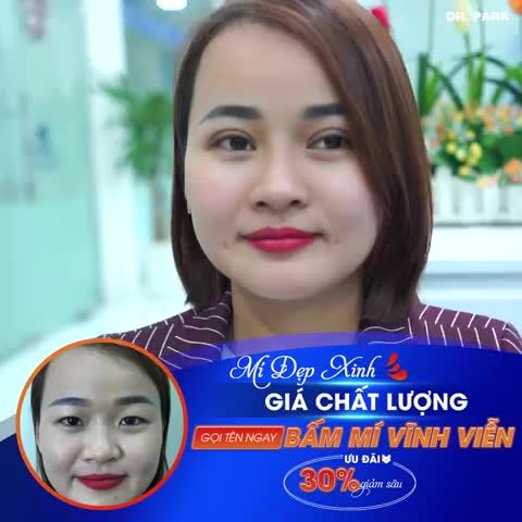 BẠN ĐÃ BIẾT CHĂM SÓC MẮT ĐÚNG CÁCH SAU KHI BẤM MÍ CHƯA