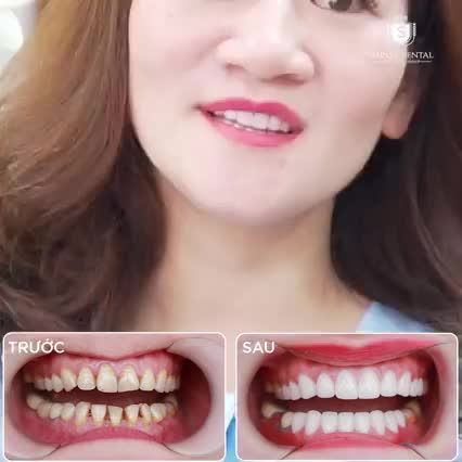Chất lượng đi cùng với giá trị!