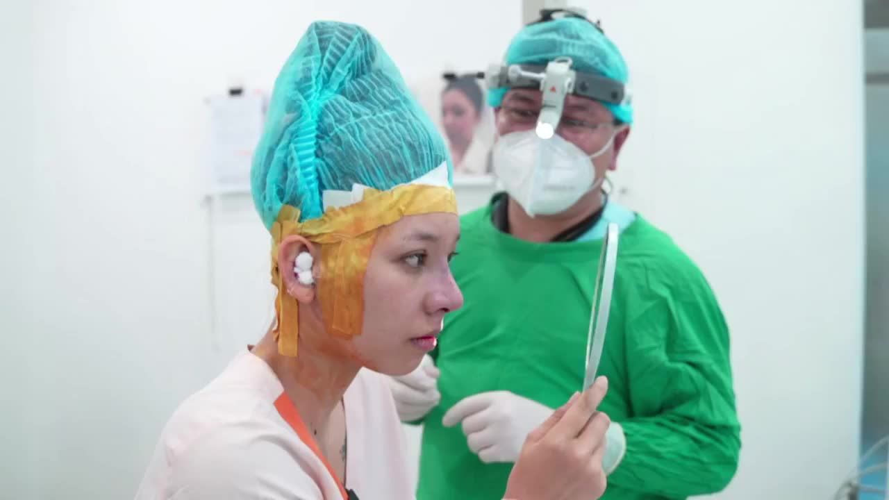 Khắc phục đầu mũi to cho khách hàng từng tiêm filler